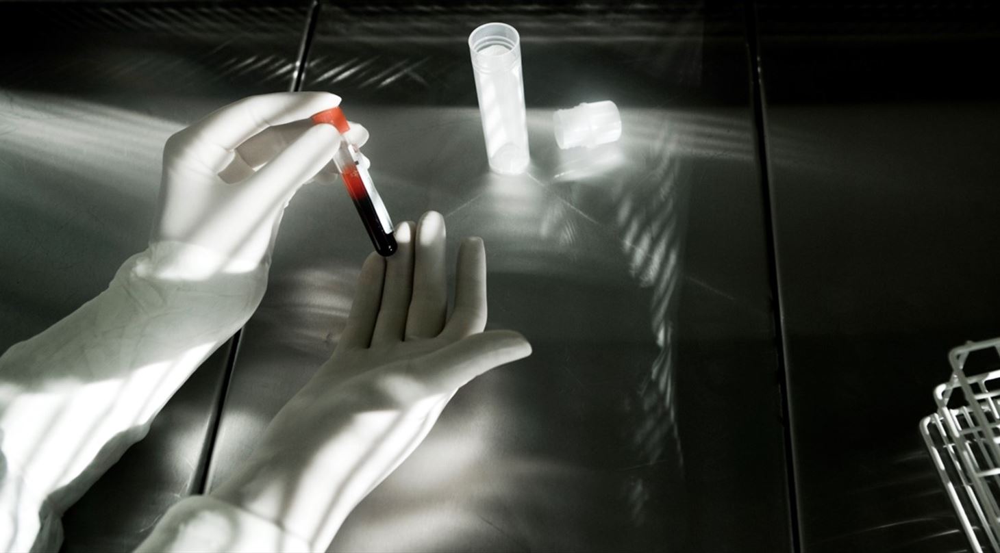 Foto af blodprøve, der håndteres iført hvide gummihandsker